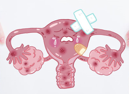 CHIRURGIA GINECOLOGICA
