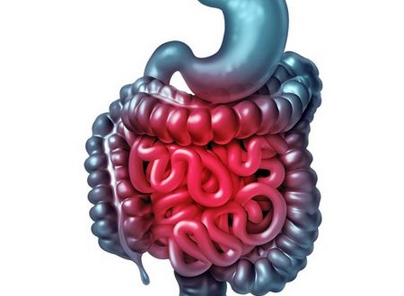 INTESTINAL CHRONIC INFLAMMATORY DISEASES (IBD)