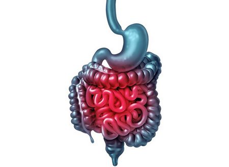 MALATTIE INFIAMMATORIE CRONICHE INTESTINALI (IBD) 
