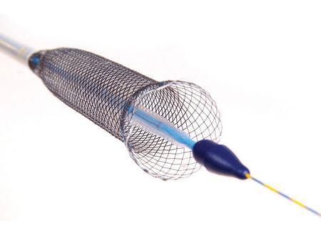 GASTROINTESTINAL METALLIC STENTS