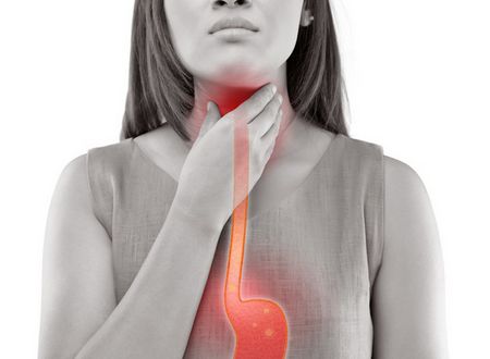TRATTAMENTI PER IL REFLUSSO GASTRO-ESOFAGEO